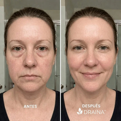 DRAINA™ – Cepillo de Drenaje Linfático Facial